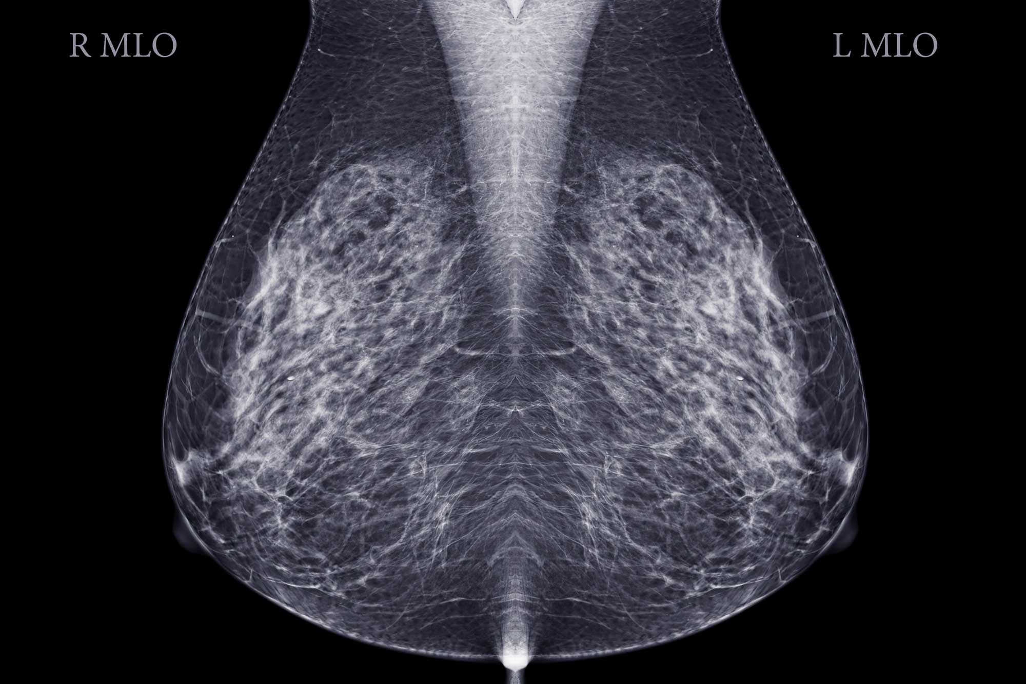 studio radiologico ruggiero mammografia rx prato